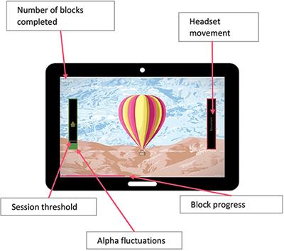 Home-Based EEG Neurofeedback Intervention for the Management of Chronic Pain